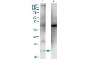 Western Blot analysis of CLPS expression in transfected 293T cell line by CLPS monoclonal antibody (M05), clone 4G3. (CLPS 抗体  (AA 23-112))