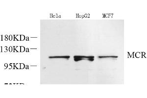 Western Blot analysis of various samples using Mineralocorticoid receptor Polyclonal Antibody at dilution of 1:600. (NR3C2 抗体)