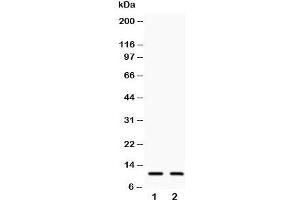 Western blot testing of Eotaxin 3 antibody and Lane 1:  COLO320;  2: A549;  Predicted size: 11KD;  Observed size: 11KD (CCL26 抗体  (C-Term))