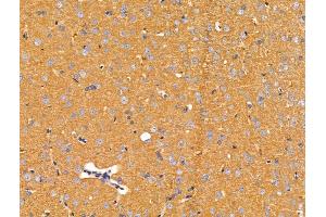 ABIN7094708 and ABIN7098759 at 1/100 staining Rat brain tissue by IHC-P. (ACTR1A 抗体  (Internal Region))