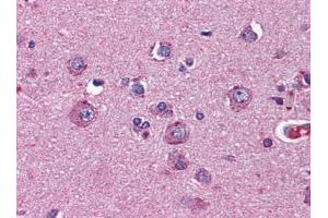 Immunohistochemistry (IHC) image for anti-Netrin G2 (NTNG2) (AA 21-120) antibody (ABIN614733) (Netrin G2 抗体  (AA 21-120))