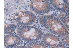 Detection of IL4 in Rat Intestine Tissue using Monoclonal Antibody to Interleukin 4 (IL4) (IL-4 抗体  (AA 61-111))