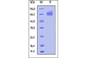 SDS-PAGE (SDS) image for Colony Stimulating Factor 1 Receptor (CSF1R) (AA 20-512) (Active) protein (His tag,AVI tag,Biotin) (ABIN5674603)