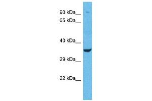 Western Blotting (WB) image for anti-Olfactory Receptor, Family 1, Subfamily L, Member 1 (OR1L1) (N-Term) antibody (ABIN2791714)
