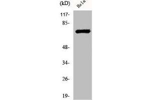 Western Blot analysis of HeLa cells using Phospho-LIMK-1/2 (T508/505) Polyclonal Antibody (LIM Domain Kinase 1/2 (LIMK1/2) (pThr505), (pThr508) 抗体)