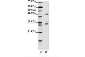 Image no. 2 for anti-PHD Finger Protein 1 (PHF1) (AA 421-470) antibody (ABIN202770) (PHF1 抗体  (AA 421-470))