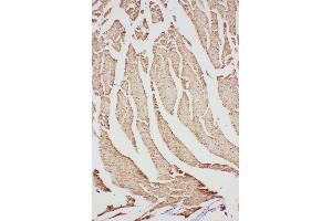 Immunohistochemistry (IHC) image for anti-Voltage-Dependent Anion Channel 1 (VDAC1) (AA 163-178), (Middle Region) antibody (ABIN3044167)