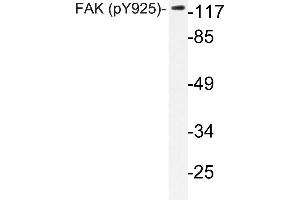 Western blot (WB) analyzes of p-FAK antibody in extracts from HepG2 cells. (FAK 抗体  (pTyr925))