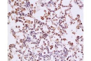 Formalin-fixed and paraffin embedded rat lung tissue labeled with Anti-STAT3 Polyclonal Antibody, Unconjugated at 1:200 followed by conjugation to the secondary antibody , (SP-0023), and DAB staining (STAT3 抗体  (AA 233-330))