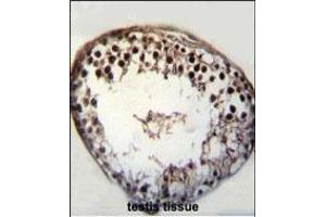 BRSK1 Antibody (C-term) (ABIN652432 and ABIN2842239) immunohistochemistry analysis in formalin fixed and paraffin embedded human testis tissue followed by peroxidase conjugation of the secondary antibody and DAB staining. (BRSK1 抗体  (C-Term))