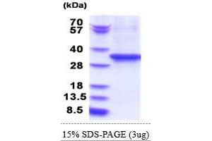 SDS-PAGE (SDS) image for Eukaryotic Translation Elongation Factor 2 (EEF2) (AA 574-858) protein (His tag) (ABIN5853814)