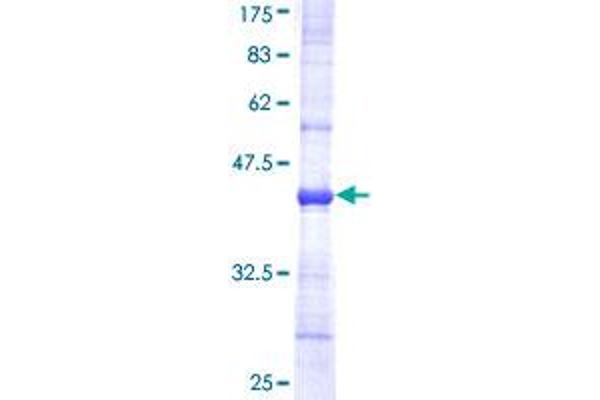 NDUFB5 Protein (AA 95-189) (GST tag)