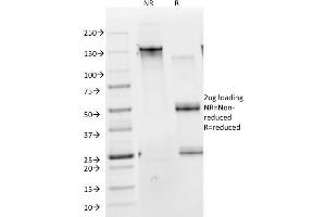 SDS-PAGE Analysis Purified Cytokeratin 10 Monoclonal Antibody (DE-K10). (Keratin 10 抗体)