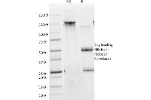 SDS-PAGE Analysis Purified Cytokeratin 10 Monoclonal Antibody (DE-K10).