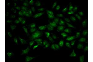 Immunofluorescence analysis of HeLa cell using YWHAB antibody. (YWHAB 抗体)