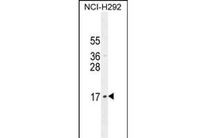 LLPH Antibody (Center) (ABIN654797 and ABIN2844474) western blot analysis in NCI- cell line lysates (35 μg/lane). (LLPH 抗体  (AA 62-90))