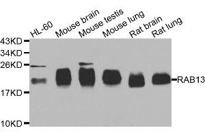 Western blot analysis of extracts of various cell lines, using RAB31 antibody. (RAB31 抗体)
