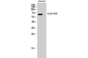 Western Blotting (WB) image for anti-CstF-64T (Internal Region) antibody (ABIN3180563) (CstF-64T (Internal Region) 抗体)