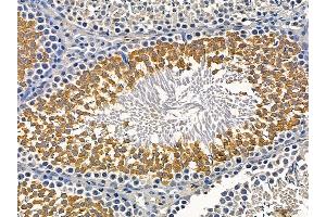 ABIN7095528 and ABIN7099585 at 1/100 staining rat testis tissue by IHC-P. (DYNC2H1 抗体)