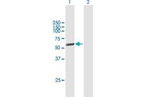 Western Blot analysis of PICK1 expression in transfected 293T cell line by PICK1 MaxPab polyclonal antibody. (PICK1 抗体  (AA 1-415))