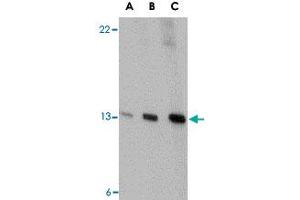 Western blot analysis of PSENEN in K-562 cell lysate with PSENEN polyclonal antibody  at (A) 0. (PEN2 抗体  (C-Term))
