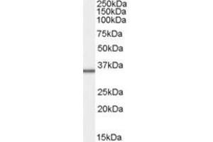 Image no. 1 for anti-Mitochondrial Ribosomal Protein L3 (MRPL3) (C-Term) antibody (ABIN374279) (MRPL3 抗体  (C-Term))