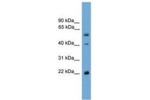 Image no. 1 for anti-WW Domain Binding Protein 4 (WBP4) (AA 35-84) antibody (ABIN6744958) (WBP4 抗体  (AA 35-84))