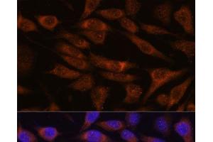 Immunofluorescence analysis of L929 cells using UNC13B Polyclonal Antibody at dilution of 1:100. (UNC13B 抗体)