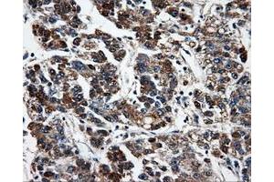 Immunohistochemistry (IHC) image for anti-Fumarylacetoacetate Hydrolase Domain Containing 2A (FAHD2A) antibody (ABIN1498182) (FAHD2A 抗体)