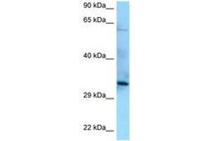 Image no. 1 for anti-Protein Phosphatase 6, Catalytic Subunit (PPP6C) (AA 90-139) antibody (ABIN6748166) (PPP6C 抗体  (AA 90-139))