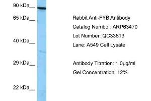 Western Blotting (WB) image for anti-FYN-Binding Protein (FYB) (C-Term) antibody (ABIN2789512) (FYB 抗体  (C-Term))