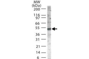 Western blot analysis of SMAD6 in 30 ug of Jurkat cell lysate using SMAD6 polyclonal antibody  at 2 ug/mL . (SMAD6 抗体  (AA 85-99))