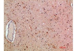 Immunohistochemical analysis of paraffin-embedded human-brain, antibody was diluted at 1:200 (MLL/KMT2A 抗体  (AA 3850-3900))