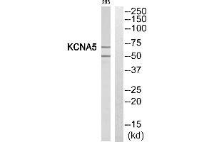 Western blot analysis of extracts from 293 cells, using KCNA5 antibody. (KCNA5 抗体  (Internal Region))