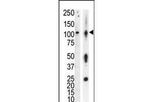Western blot analysis of anti-PKCnu Pab in lysate of HL60 cells stimulated with PMA (lane A) and mouse brain tissue lysate (lane B)