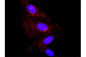 Proximity Ligation Analysis of protein-protein interactions between IL1B and A2M. (alpha 2 Macroglobulin 抗体  (AA 641-730))