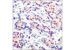 Immunohistochemistry (IHC) image for anti-Jun D Proto-Oncogene (JUND) (Ser255) antibody (ABIN1848124) (JunD 抗体  (Ser255))