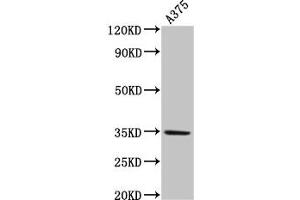 Western Blot Positive WB detected in: A375 whole cell lysate All lanes: MC1R antibody at 4 μg/mL Secondary Goat polyclonal to rabbit IgG at 1/50000 dilution Predicted band size: 35 kDa Observed band size: 35 kDa (MC1 Receptor 抗体  (AA 1-37))