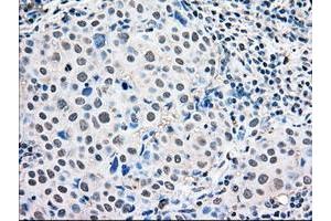 Image no. 2 for anti-Mitogen-Activated Protein Kinase 1 (MAPK1) antibody (ABIN1499287) (ERK2 抗体)