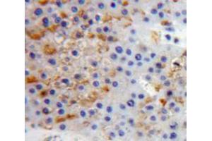 Immunohistochemistry (IHC) image for anti-Protein tyrosine Phosphatase, Receptor Type, S (PTPRS) (AA 77-361) antibody (ABIN1863080)