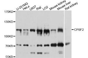 Western blot analysis of extracts of various cells, using CPSF2 antibody. (CPSF2 抗体)