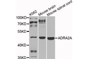Western blot analysis of extracts of various cell lines, using ADRA2A antibody. (ADRA2A 抗体)