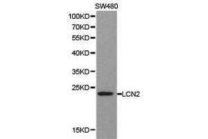Western Blotting (WB) image for anti-Lipocalin 2 (LCN2) antibody (ABIN1873521) (Lipocalin 2 抗体)