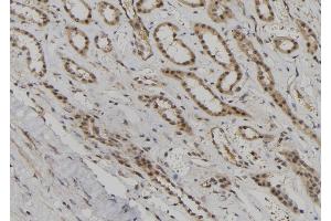 ABIN6260330 and ABIN6276872 at 1/100 staining Human kidney tissue by IHC-P. (BUB1B 抗体  (C-Term))