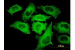 Immunofluorescence of monoclonal antibody to TIPIN on HeLa cell. (TIPIN 抗体  (AA 1-301))
