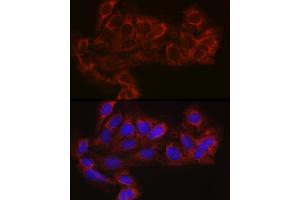 Immunofluorescence analysis of U-2 OS cells using EIF4E2 Rabbit pAb (ABIN6130366, ABIN6140086, ABIN6140087 and ABIN6220578) at dilution of 1:100 (40x lens). (EIF4E2 抗体  (AA 1-240))
