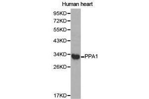 Western Blotting (WB) image for anti-Pyrophosphatase (Inorganic) 1 (PPA1) antibody (ABIN1874203) (Pyrophosphatase (Inorganic) 1 (PPA1) 抗体)