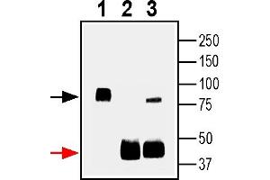 Immunoprecipitation of rat brain lysates using SV2A antibody1. (SV2A 抗体  (Intracellular))