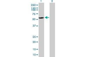 Western Blot analysis of RAD23B expression in transfected 293T cell line by RAD23B MaxPab polyclonal antibody. (RAD23B 抗体  (AA 1-409))