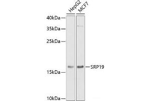 Western blot analysis of extracts of various cell lines using SRP19 Polyclonal Antibody at dilution of 1:1000. (SRP19 抗体)